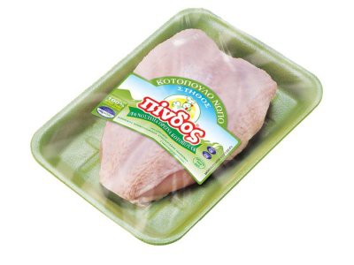Στήθος